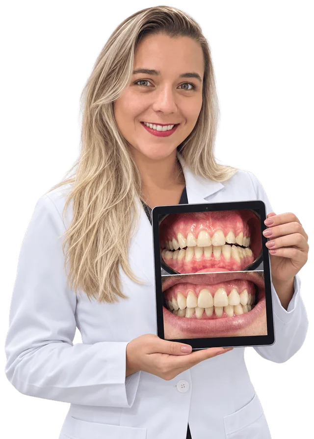 Dentista da Plage Odontologia mostrando um caso de lentes de contato dentárias